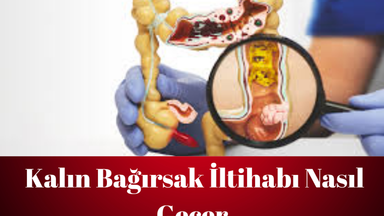 Kalın Bağırsak İltihabına Son! Doğal Yöntemlerle Şifa Bulun