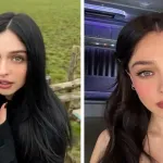 Cemre Baysel Yeni Saç Modeli Sonrası Ameliyat Açıklamasıyla Dikkat Çekti