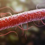 Listeria Bakterisi Çıkan Marka Hangisi? Listeria Bakterisi Nedir, Nasıl Oluşur? Ne Yapar, Nelerde Bulunur?