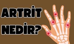 Artrit Nedir?