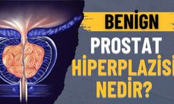 Benign Prostat Hiperplazisi Nedir?