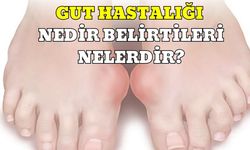 Gut Hastalığı Nedir Belirtileri Nelerdir?