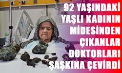 92 Yaşındaki Yaşlı Kadının Midesinden Çıkanlar Doktorları Şaşkına Çevirdi