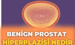 Benign Prostat Hiperplazisi Nedir