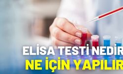 Elisa Testi Nedir Ne İçin Yapılır