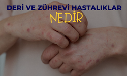 Deri Ve Zührevi Hastalıklar Nedir