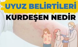 Uyuz Belirtileri Kurdeşen Nedir