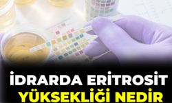 İdrarda Eritrosit Yüksekliği Nedir