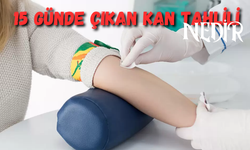 15 Günde Çıkan Kan Tahlili Nedir