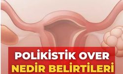 Polikistik Over Nedir, Belirtileri