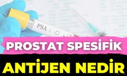 Prostat Spesifik Antijen Nedir