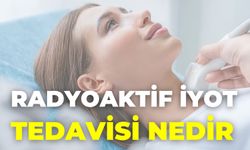 Radyoaktif İyot Tedavisi Nedir