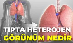 Tıpta Heterojen Görünüm Nedir