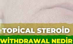 Topical Steroid Withdrawal Nedir