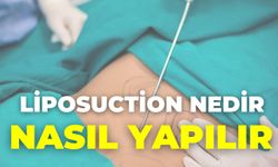 Liposuction Nedir, Nasıl Yapılır