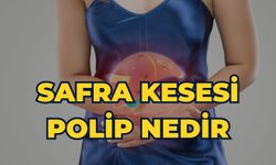 Safra Kesesi Polip Nedir