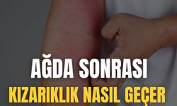 Ağda Sonrası Kızarıklık Nasıl Geçer