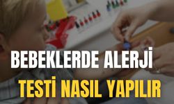 Bebeklerde Alerji Testi Nasıl Yapılır