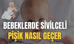 Bebeklerde Sivilceli Pişik Nasıl Geçer
