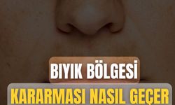 Bıyık Bölgesi Kararması Nasıl Geçer