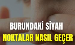 Burundaki Siyah Noktalar Nasıl Geçer