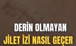 Derin Olmayan Jilet İzi Nasıl Geçer