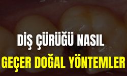 Diş Çürüğü Nasıl Geçer Doğal Yöntemler