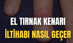 El Tırnak Kenarı İltihabı Nasıl Geçer