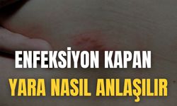 Enfeksiyon Kapan Yara Nasıl Anlaşılır