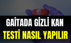 Gaitada Gizli Kan Testi Nasıl Yapılır