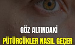 Göz Altındaki Pütürcükler Nasıl Geçer