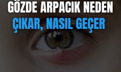 Gözde Arpacık Neden Çıkar, Nasıl Geçer