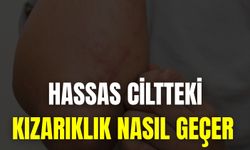 Hassas Ciltteki Kızarıklık Nasıl Geçer