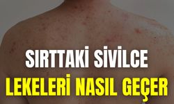 Sırttaki Sivilce Lekeleri Nasıl Geçer