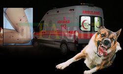 Şanlıurfa’da Başıboş Köpek Saldırısı: Küçük Çocuk Yaralandı