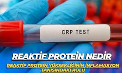 Reaktif Protein Nedir:Reaktif Protein Yüksekliğinin İnflamasyon Tanısındaki Rolü
