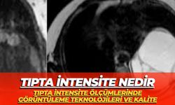 Tıpta İntensite Nedir:Tıpta İntensite Ölçümlerinde Görüntüleme Teknolojileri ve Kalite