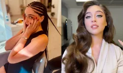 Cemre Baysel Yeni Saç Modeli Sonrası Ameliyat Açıklamasıyla Dikkat Çekti