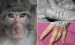 Maymun Isırığı Öldürücü Mü? Maymun Isırığı Belirtileri, Enfeksiyon Riski, Kuduz Tehlikesi ve Yapılması Gerekenler