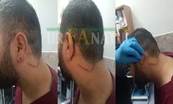 Serkan Orhangazi'ye Yapılan Saldırıya İlişkin Şanlıurfa İl Sağlık Müdürlüğü'nden Açıklama