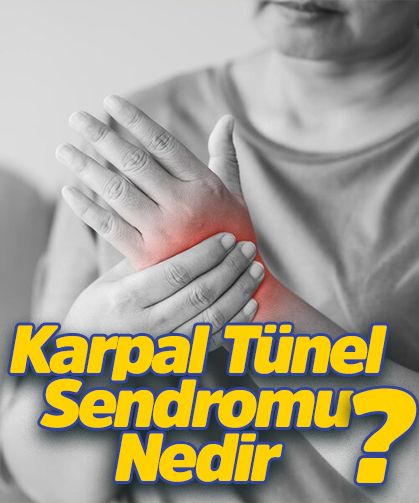 Karpal Tünel Sendromu Nedir?