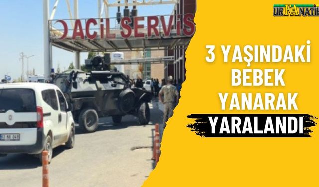 Şanlıurfa’da 3 Yaşındaki Elif Nur’a Sıcak Su Döküldü