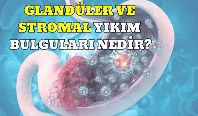 Glandüler Ve Stromal Yıkım Bulguları Nedir?