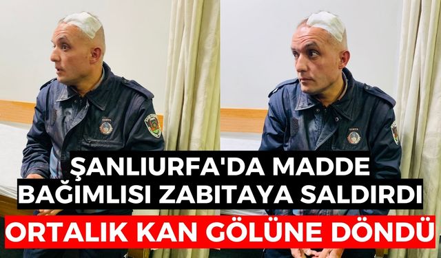 Şanlıurfa'da Alkollü Şahıs Zabıtaya Saldırdı: Ortalık Kan Gölüne Döndü