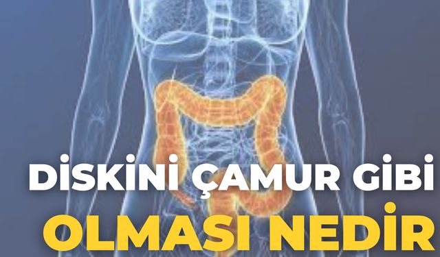 Diskini Çamur Gibi Olması Nedir