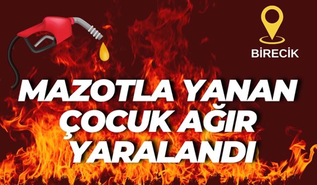 Şanlıurfa’da Mazotla Yanan Çocuk Ağır Yaralandı