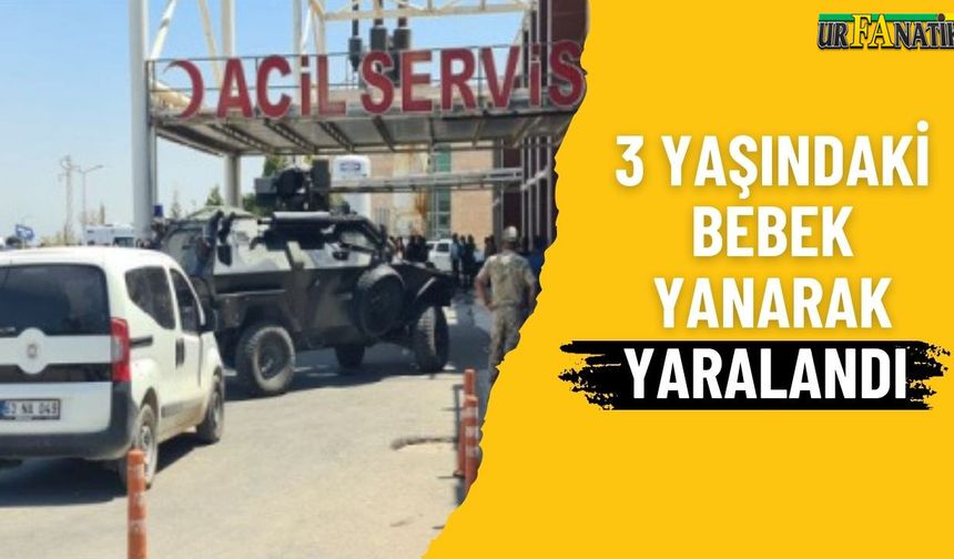 Şanlıurfa’da 3 Yaşındaki Elif Nur’a Sıcak Su Döküldü