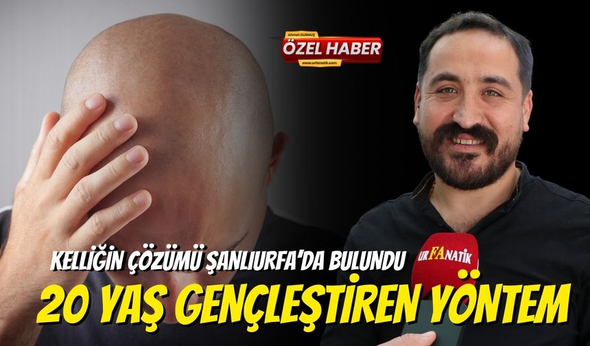 Kelliğin Çözümü Şanlıurfa’da Bulundu! 20 Yaş Gençleştiren Yöntem