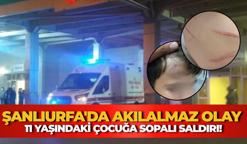 Şanlıurfa'da Akılalmaz Olay: 11 Yaşındaki Çocuğa Sopalı Saldırı!