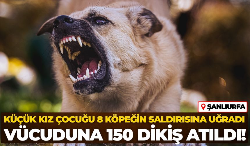 Şanlıurfa'da Küçük Kız Çocuğu 8 Köpeğin Saldırısına Uğradı: Vücuduna 150 Dikiş Atıldı